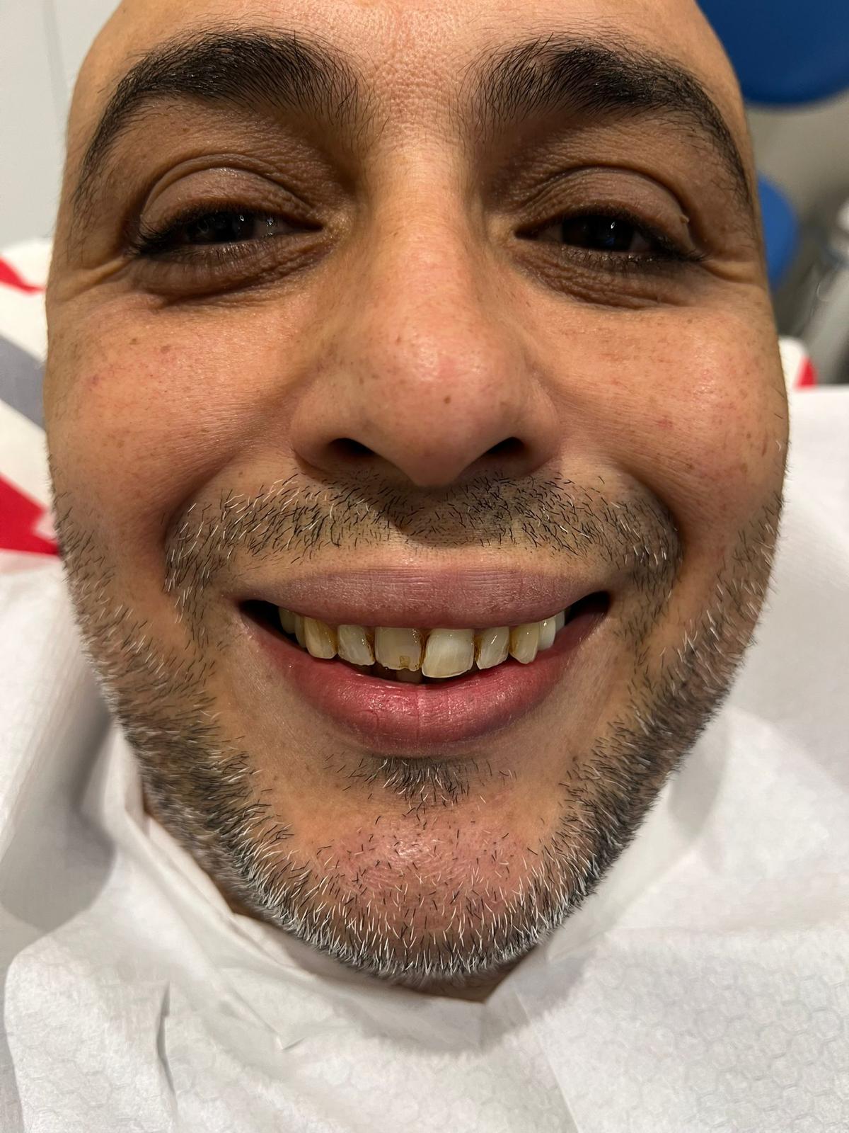 ECE Dental Patient Transformation